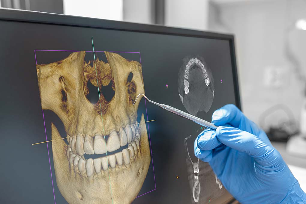 Dentista analizando un caso extremo observando una radiografía digital